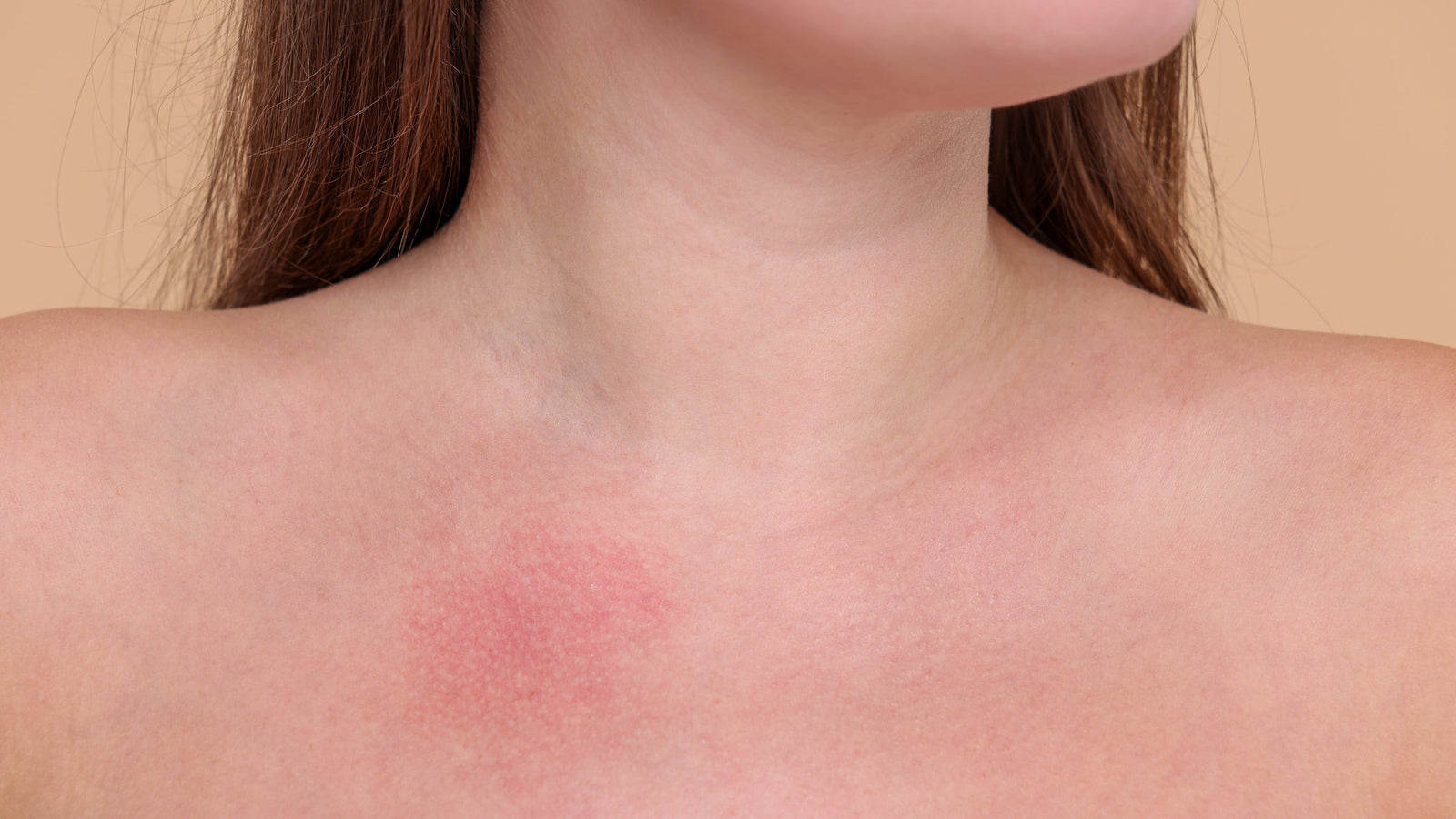 Is It a Laundry Detergent Allergy? Why Your Detergent May be Irritating Your Skin