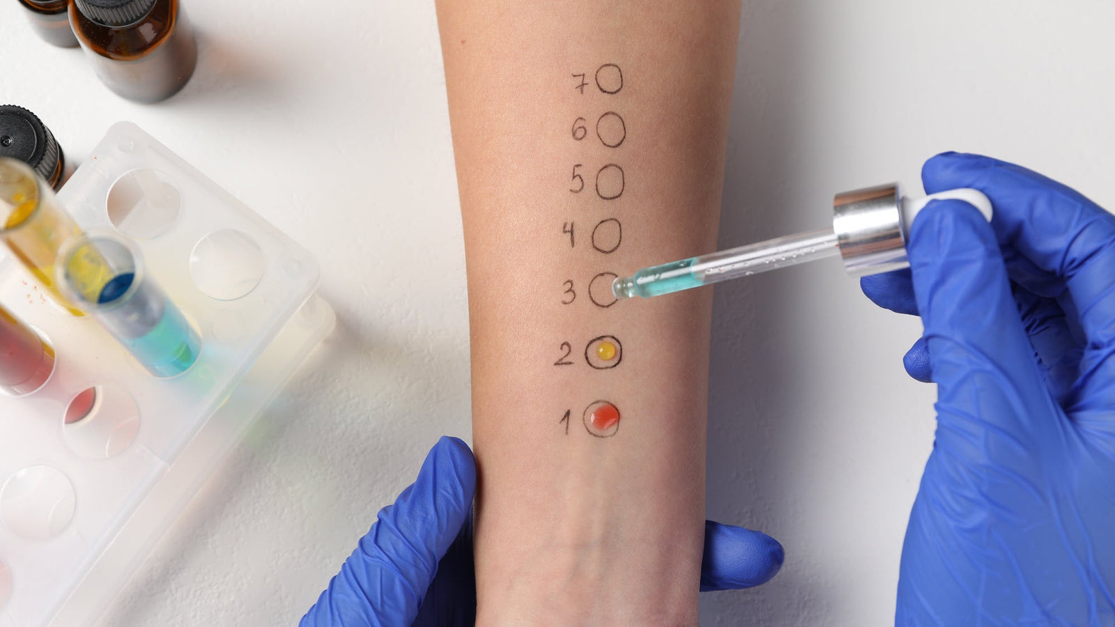 Doctor doing skin allergy test 